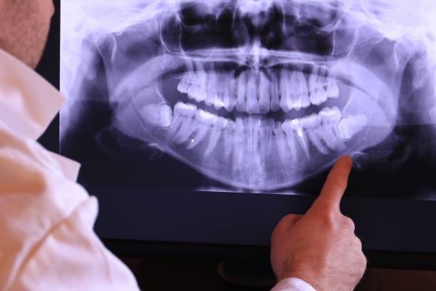 Best Broken or Chipped Tooth Repair in Northwest Harwinton, CT