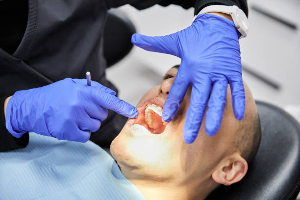 Best Knocked-Out Tooth (Avulsed Tooth) Treatment in Northwest Harwinton, CT